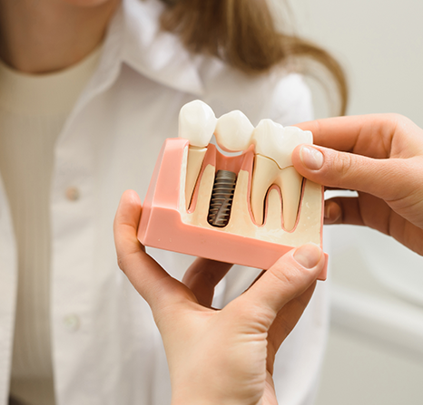 A doctor showing a dental model with an implant.